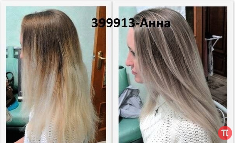 Виды кожных образований (родинка, бородавка.) Боль после инсульта Сайт врача Самолетовой Д. Я
